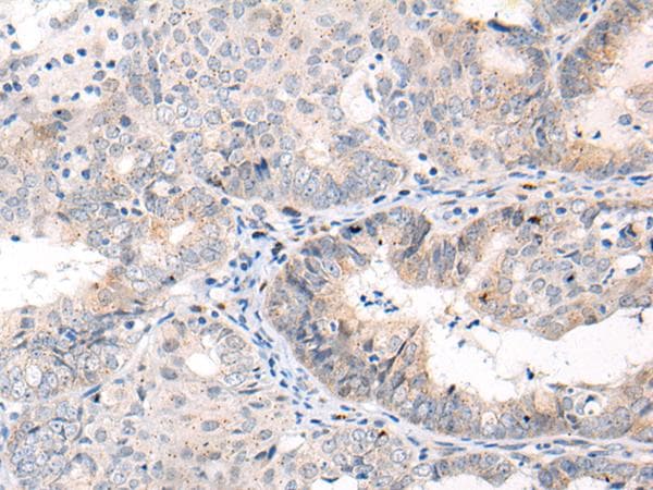Polyclonal Rabbit anti-Human ANAPC15 Antibody (IHC)