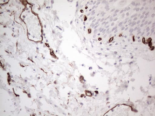 CD34 Antibody (aa312-385, clone OTI11E1)