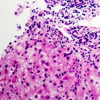 NDUFB9 Antibody (Internal)