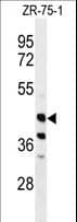 Polyclonal Rabbit anti-Human FA2H / FAAH Antibody (aa121-148, IHC, WB)