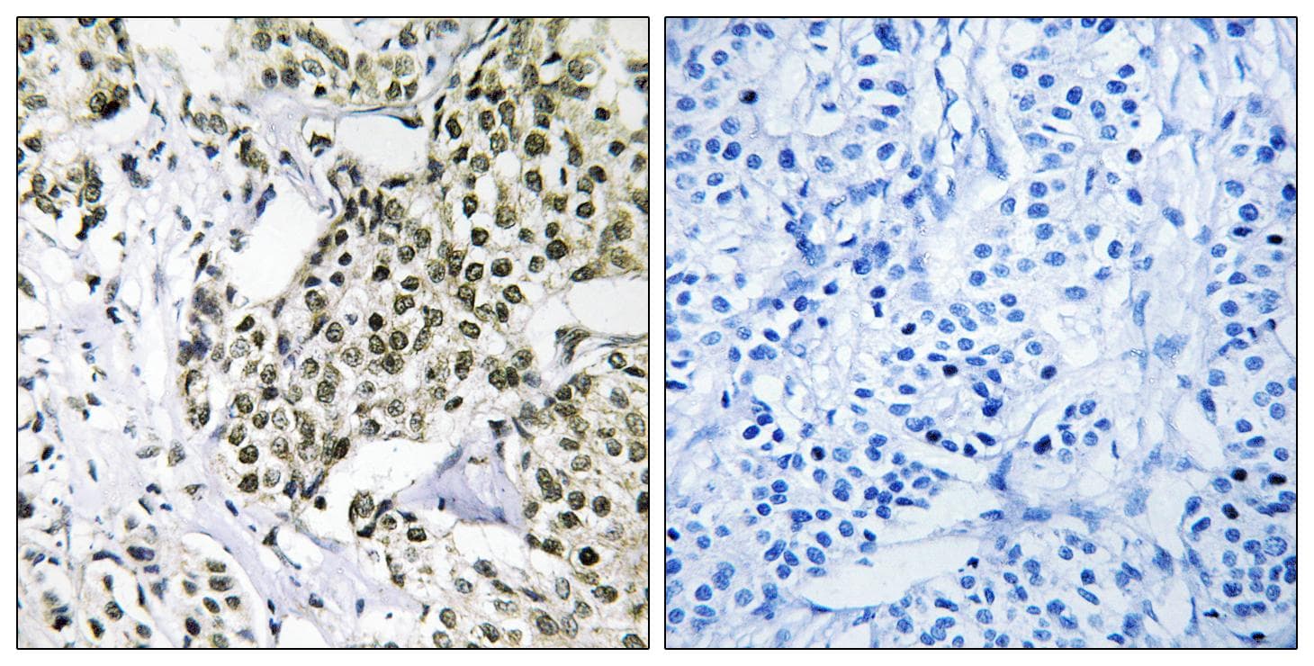 CAGE1 / Cancer Antigen 1 Antibody