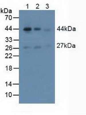 ACTA2 / Smooth Muscle Actin Antibody (aa167-377, APC)