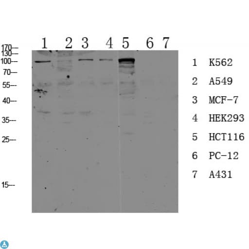 CDH17 / Cadherin 17 Antibody