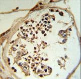 LYAR Antibody (aa38-66)