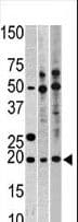 RPL23A Antibody (aa111-140)