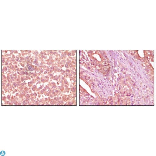 EPHA2 / EPH Receptor A2 Antibody