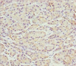 Polyclonal Rabbit anti-Human PACSIN2 Antibody (IHC, WB)