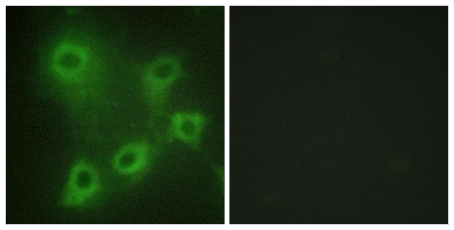 SYK Antibody (Ab-323)