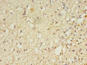 Polyclonal Rabbit anti-Human RGS7 Antibody (IHC)