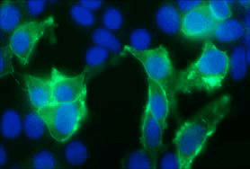 Monoclonal Mouse anti-Human TRPV3 Antibody (clone S15-39, aa458-474, IHC, IF, WB)