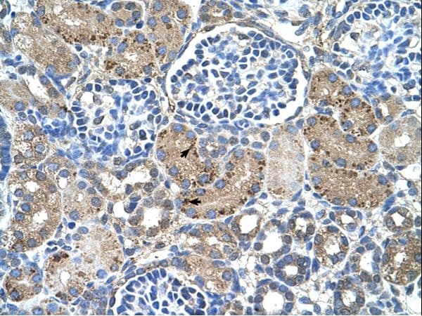 GLS2 / Glutaminase 2 Antibody (aa241-290)