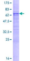 Human ASPN / Asporin Protein (Recombinant GST)