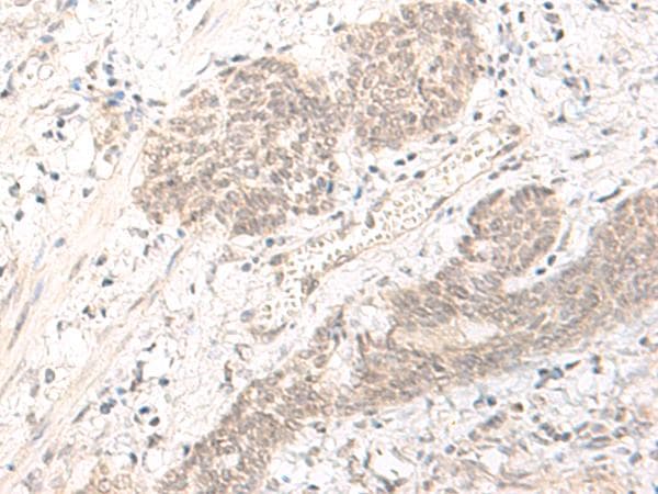 PBXIP1 / HPIP Antibody