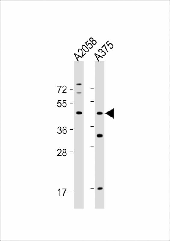 ST8SIA1 Antibody (N-Terminus)