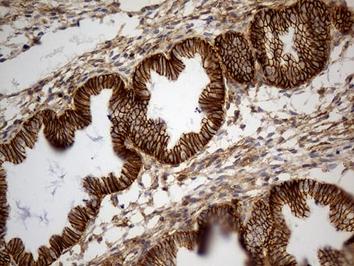 CD99 Antibody (clone OTI1A1)