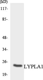LYPLA1 Antibody (aa41-90)