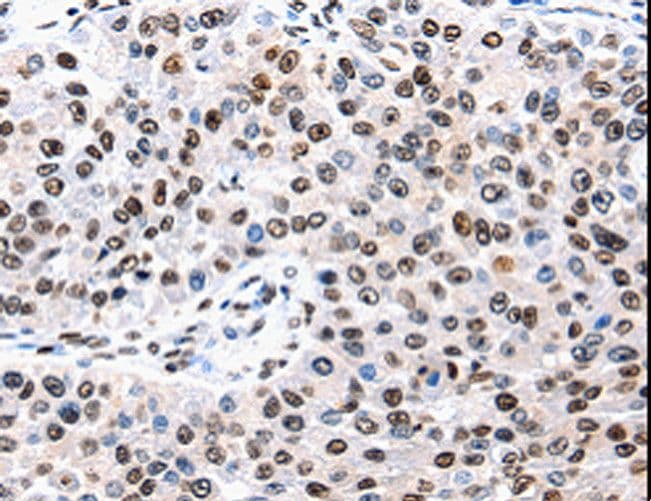 AQP2 / Aquaporin 2 Antibody