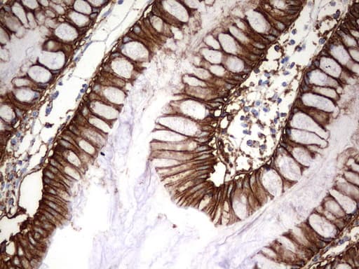 EPCAM Antibody (clone UMAB132)