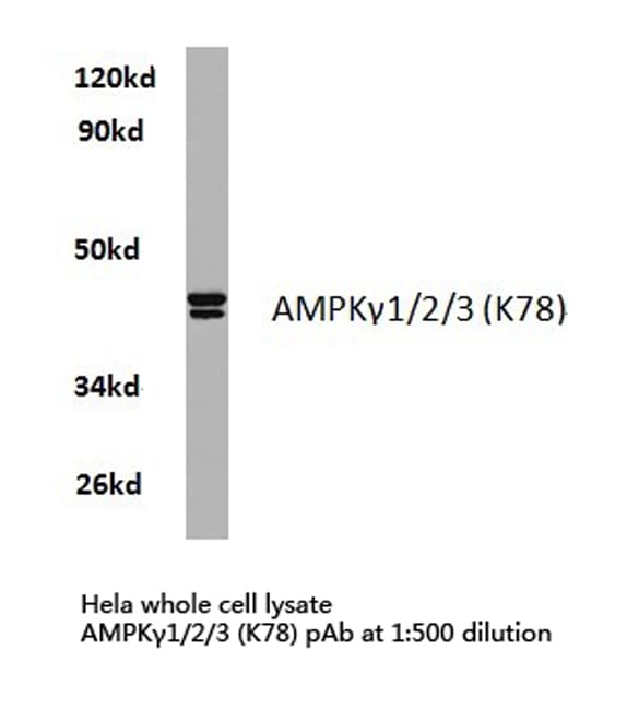 AMPK Beta 1+2+3 Antibody (Lys78)
