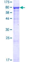 Human INTS9 Protein (Recombinant GST)