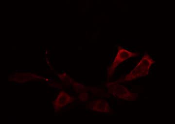 Polyclonal Rabbit anti-Human AVPR1B Antibody (IF, WB)