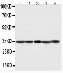 Polyclonal Rabbit anti-Human CDK1 / CDC2 Antibody (aa279-297, WB)