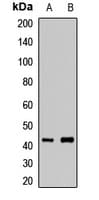 HOXA10 Antibody