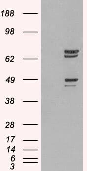IHC-plus™ Polyclonal Goat anti-Human PTPN11 / SHP-2 / NS1 Antibody (aa584-597, IHC, IF, WB)