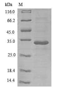 Human IL26 Protein (Recombinant 6His-B2M, N-terminus)