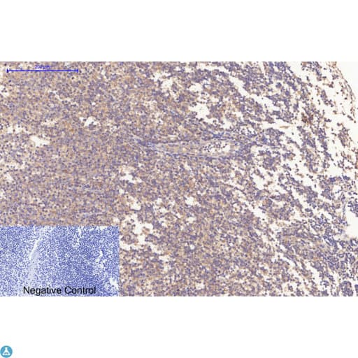 Monoclonal Mouse anti-Human BAX Antibody (IHC, WB)