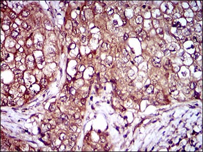 IL3RA / CD123 Antibody (aa200-305, clone 8E11C5)