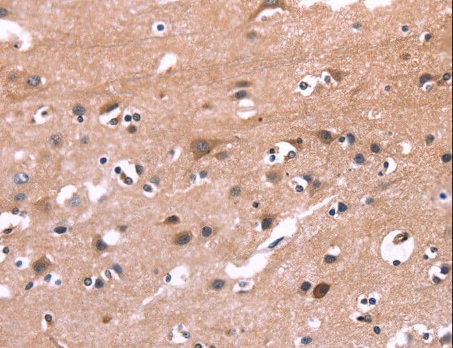 PIP5K1B Antibody