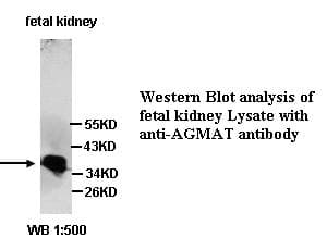AGMAT Antibody (Internal)
