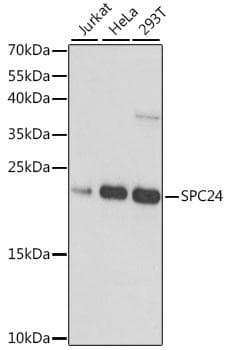 Polyclonal Rabbit anti-Human HSpc24 / SPBC24 Antibody (WB)