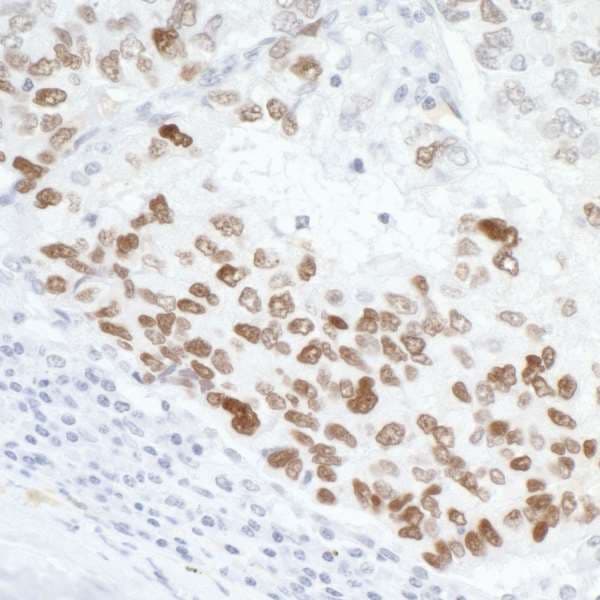 Polyclonal Rabbit anti-Human TP53 / p53 Antibody (aa50-100, IHC, WB)