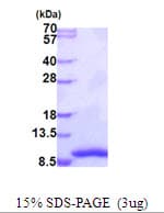 Human GTF2H5 Protein (Recombinant His)