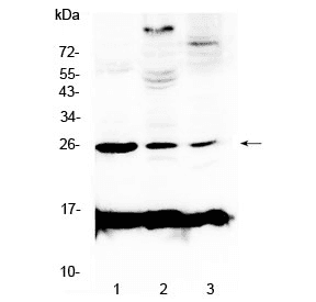 Polyclonal Rabbit anti-Mouse CRP / C-Reactive Protein Antibody (IHC, WB)
