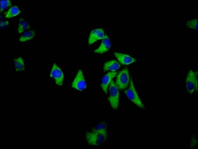 SEMA6D / Semaphorin 6D Antibody