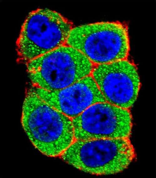 Polyclonal Rabbit anti-Human E6AP / UBE3A Antibody (aa836-865, IHC, IF, WB)