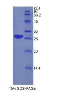 Human MPZ / P0 Protein (Recombinant His)