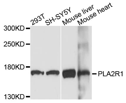 PLA2R / PLA2R1 Antibody