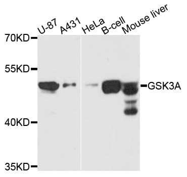 IHC-plus™ GSK3A / GSK3 Alpha Antibody