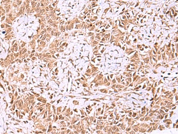 IRX1 Antibody
