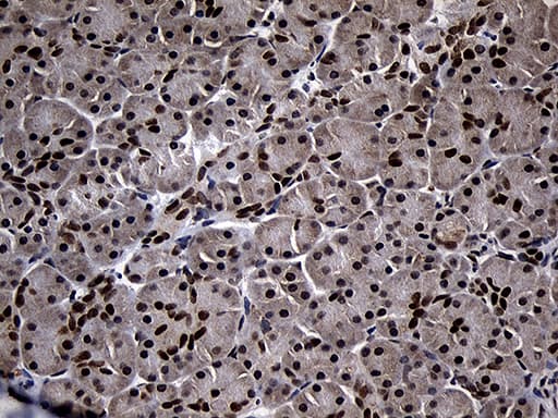 Monoclonal Mouse anti-Human SUPT16H / FACTP140 Antibody (clone OTI3B8, aa187-282, IHC, WB)