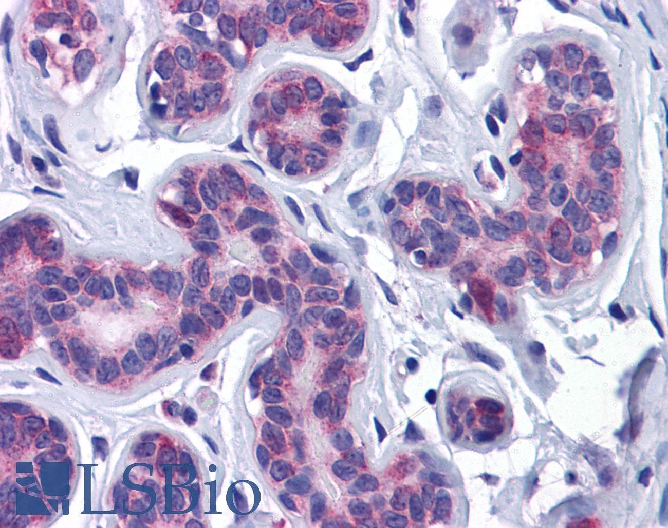 IHC-plus™ AKT3 Antibody (aa119-136)