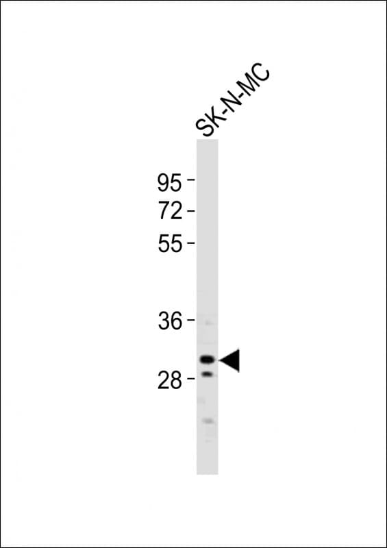 Polyclonal Rabbit anti-Human CBX7 Antibody (aa168-201, WB)
