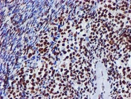 GSTT2 Antibody (clone OTI3B6)