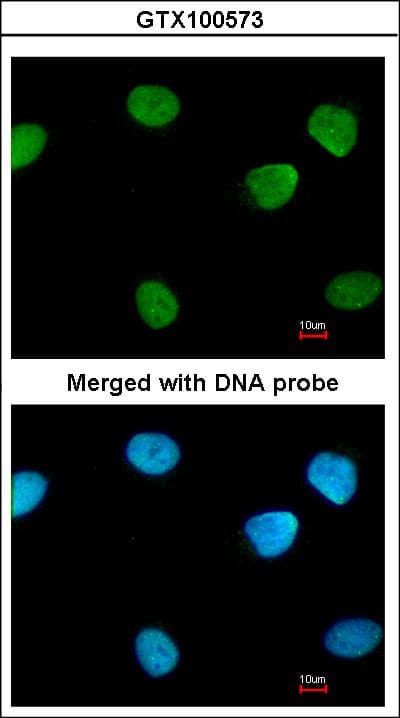 Polyclonal Rabbit anti-Human PARP1 Antibody (IF, WB)