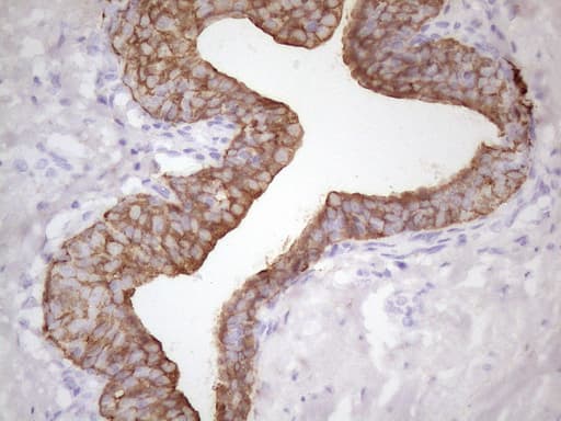 KRT16 / CK16 / Cytokeratin 16 Antibody (clone 7A4, Carrier-free)
