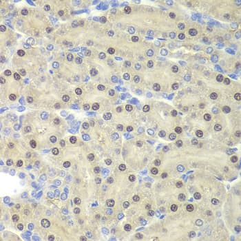 ELF3 / ESE1 Antibody